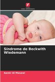 Síndrome de Beckwith Wiedemann