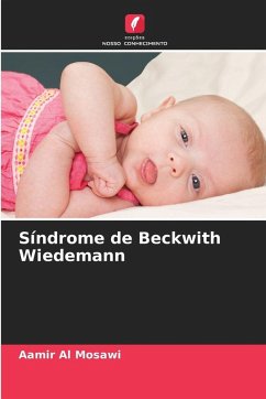 Cover Síndrome de Beckwith Wiedemann