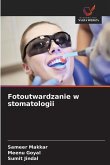 Fotoutwardzanie w stomatologii Fotoutwardzanie w stomatologii
