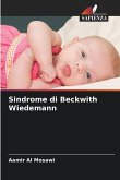 Sindrome di Beckwith Wiedemann