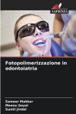 Fotopolimerizzazione in odontoiatria Fotopolimerizzazione in odontoiatria