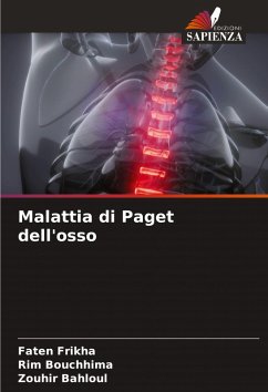 Cover Malattia di Paget dell'osso