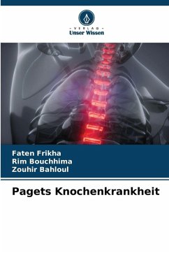 Pagets Knochenkrankheit - Frikha, Faten;Bouchhima, Rim;Bahloul, Zouhir