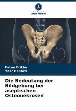 Die Bedeutung der Bildgebung bei aseptischen Osteonekrosen - Frikha, Faten;Hentati, Yosr