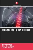 Doença de Paget do osso Doença de Paget do osso