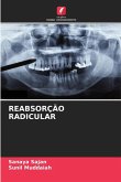 REABSORÇÃO RADICULAR REABSORÇÃO RADICULAR