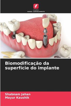 Cover Biomodificação da superfície do implante