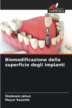 Cover Biomodificazione della superficie degli impianti