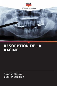 Cover RÉSORPTION DE LA RACINE