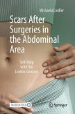 Scars After Surgeries in the Abdominal Area (eBook, PDF)