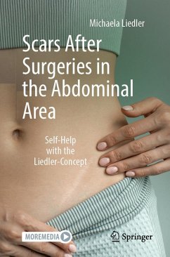 Scars After Surgeries in the Abdominal Area (eBook, PDF) - Liedler, Michaela