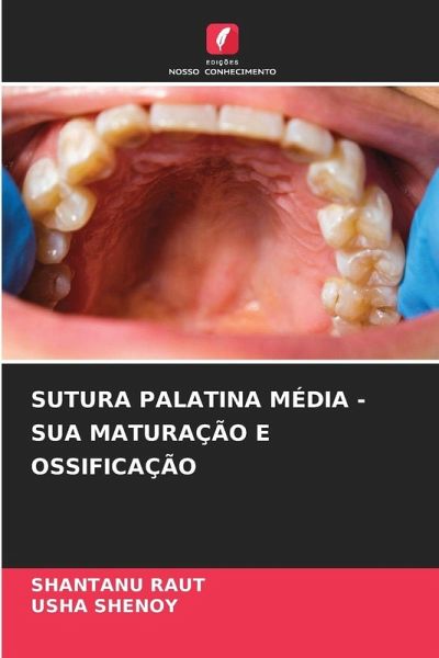 SUTURA PALATINA MÉDIA - SUA MATURAÇÃO E OSSIFICAÇÃO SUTURA PALATINA MÉDIA - SUA MATURAÇÃO E OSSIFICAÇÃO