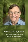 How I Got My Scar How I Got My Scar