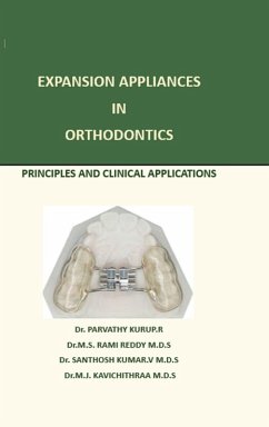 Cover Expansion Appliance in Orthodontics