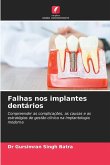 Falhas nos implantes dentários Falhas nos implantes dentários