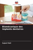 Biomécanique des implants dentaires