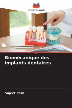 Cover Biomécanique des implants dentaires