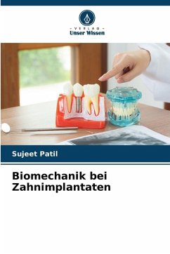 Cover Biomechanik bei Zahnimplantaten