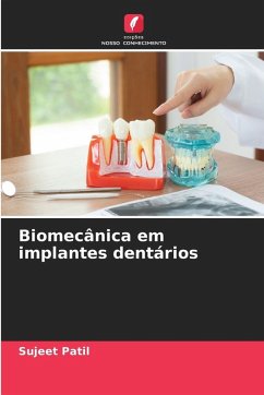 Biomecânica em implantes dentários Cover Biomecânica em implantes dentários