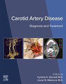 Carotid Artery Disease (eBook, ePUB)