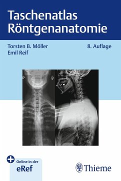 Taschenatlas Röntgenanatomie (eBook, ePUB)