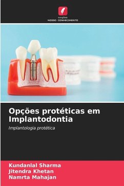 Opções protéticas em Implantodontia - sharma, Kundanlal;KHETAN, JITENDRA;MAHAJAN, NAMRTA
