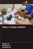 Inlay e onlay estetici