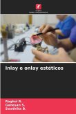 Inlay e onlay estéticos