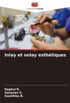 Inlay et onlay esthétiques - R., Raghul;S., Ganesan;B., Swathika Inlay et onlay esthétiques - R., Raghul;S., Ganesan;B., Swathika