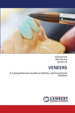 VENEERS VENEERS