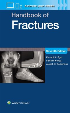 Cover Handbook of Fractures: Print + eBook with Multimedia