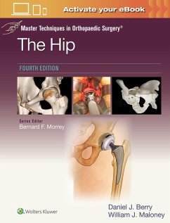 Master Techniques in Orthopaedic Surgery: The Hip: Print + eBook with Multimedia - Berry, Daniel John; Maloney, William Joseph