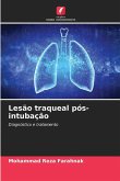 Lesão traqueal pós-intubação