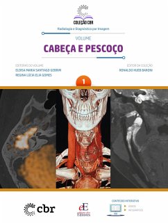 Coleção CBR Volume 1 - Cabeça e Pescoço (eBook, ePUB) - Baroni, Ronaldo Hueb; Gebrim, Eloisa Maria Santiago; Gomes, Regina Lúcia Elia