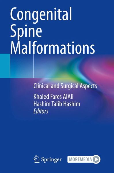 Congenital Spine Malformations Congenital Spine Malformations