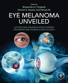 Eye Melanoma Unveiled (eBook, ePUB)