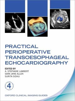 Cover Practical Perioperative Transoesophageal Echocardiography
