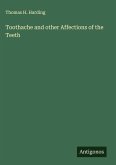 Toothache and other Affections of the Teeth