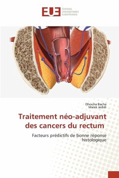 Traitement néo-adjuvant des cancers du rectum - Bacha, Dhouha;Jedidi, Malek Traitement néo-adjuvant des cancers du rectum - Bacha, Dhouha;Jedidi, Malek