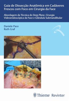Guia de Dissecção Anatômica em Cadáveres Frescos com Foco em Cirurgia da Face (eBook, ePUB) - Pace, Daniele; Graf, Ruth