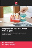 Implantes basais: Uma visão geral Implantes basais: Uma visão geral