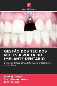 Cover GESTÃO DOS TECIDOS MOLES À VOLTA DO IMPLANTE DENTÁRIO