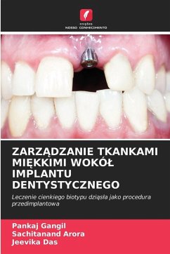 ZARZ¿DZANIE TKANKAMI MI¿KKIMI WOKÓ¿ IMPLANTU DENTYSTYCZNEGO - Gangil, Pankaj;Arora, Sachitanand;Das, Jeevika