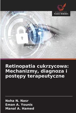 Cover Retinopatia cukrzycowa: Mechanizmy, diagnoza i post¿py terapeutyczne