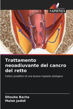 Cover Trattamento neoadiuvante del cancro del retto