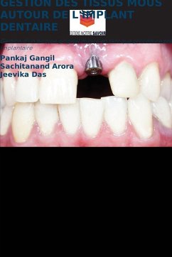 Cover GESTION DES TISSUS MOUS AUTOUR DE L'IMPLANT DENTAIRE
