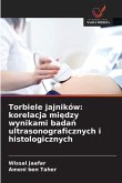 Torbiele jajników: korelacja mi¿dzy wynikami bada¿ ultrasonograficznych i histologicznych