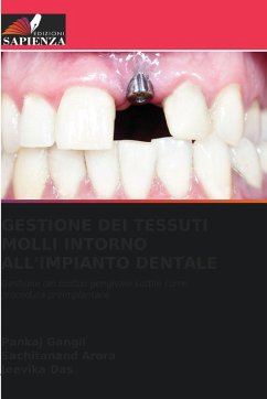 Cover GESTIONE DEI TESSUTI MOLLI INTORNO ALL'IMPIANTO DENTALE