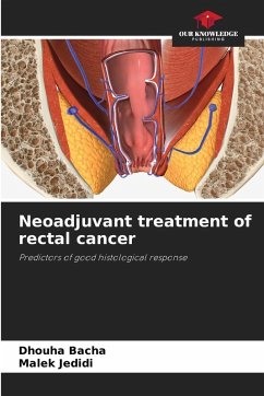 Neoadjuvant treatment of rectal cancer Cover Neoadjuvant treatment of rectal cancer