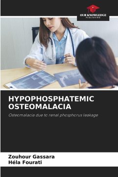 HYPOPHOSPHATEMIC OSTEOMALACIA Cover HYPOPHOSPHATEMIC OSTEOMALACIA
